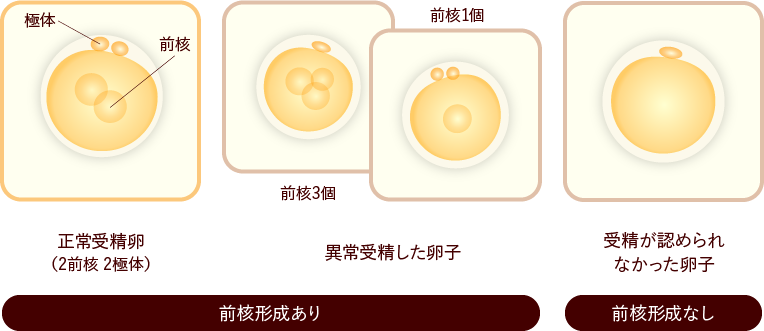 正常受精卵|異常受精した卵子|受精が認められなかった卵子