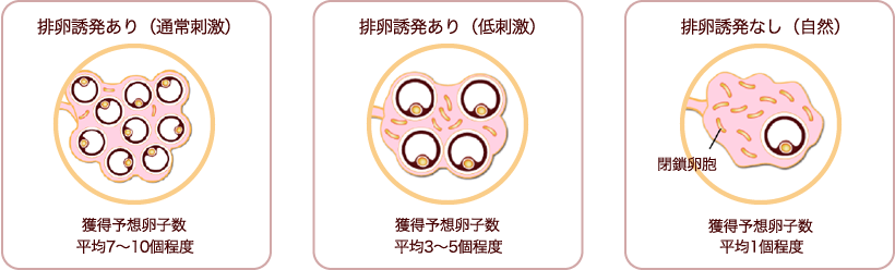 排卵誘発あり(通常刺激) 排卵誘発あり(低刺激) 排卵誘発なし(自然)